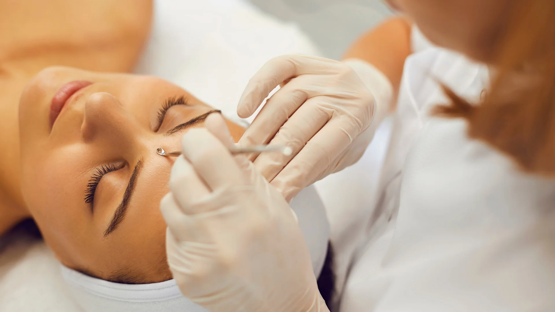 Traitement de l'Acné et des Boutons