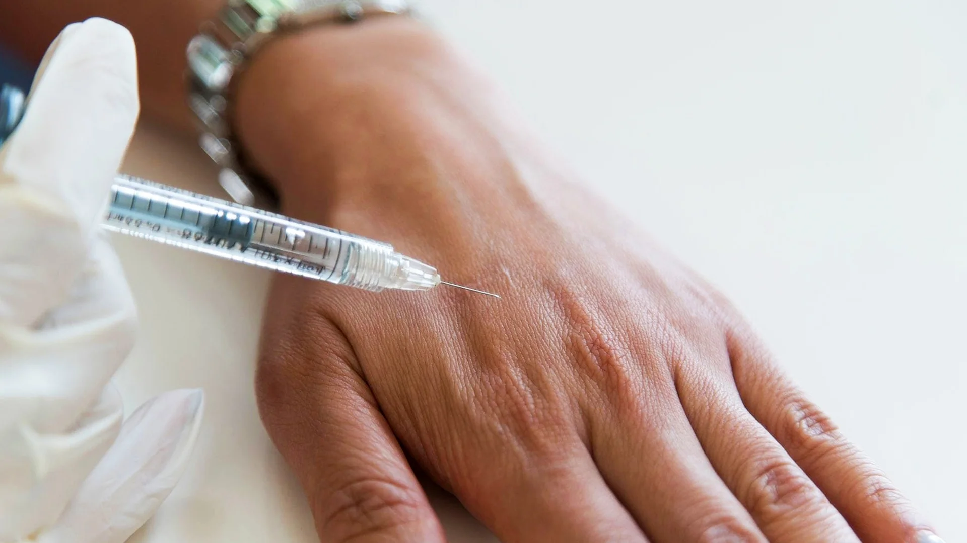 Rejuvenecimiento de Manos