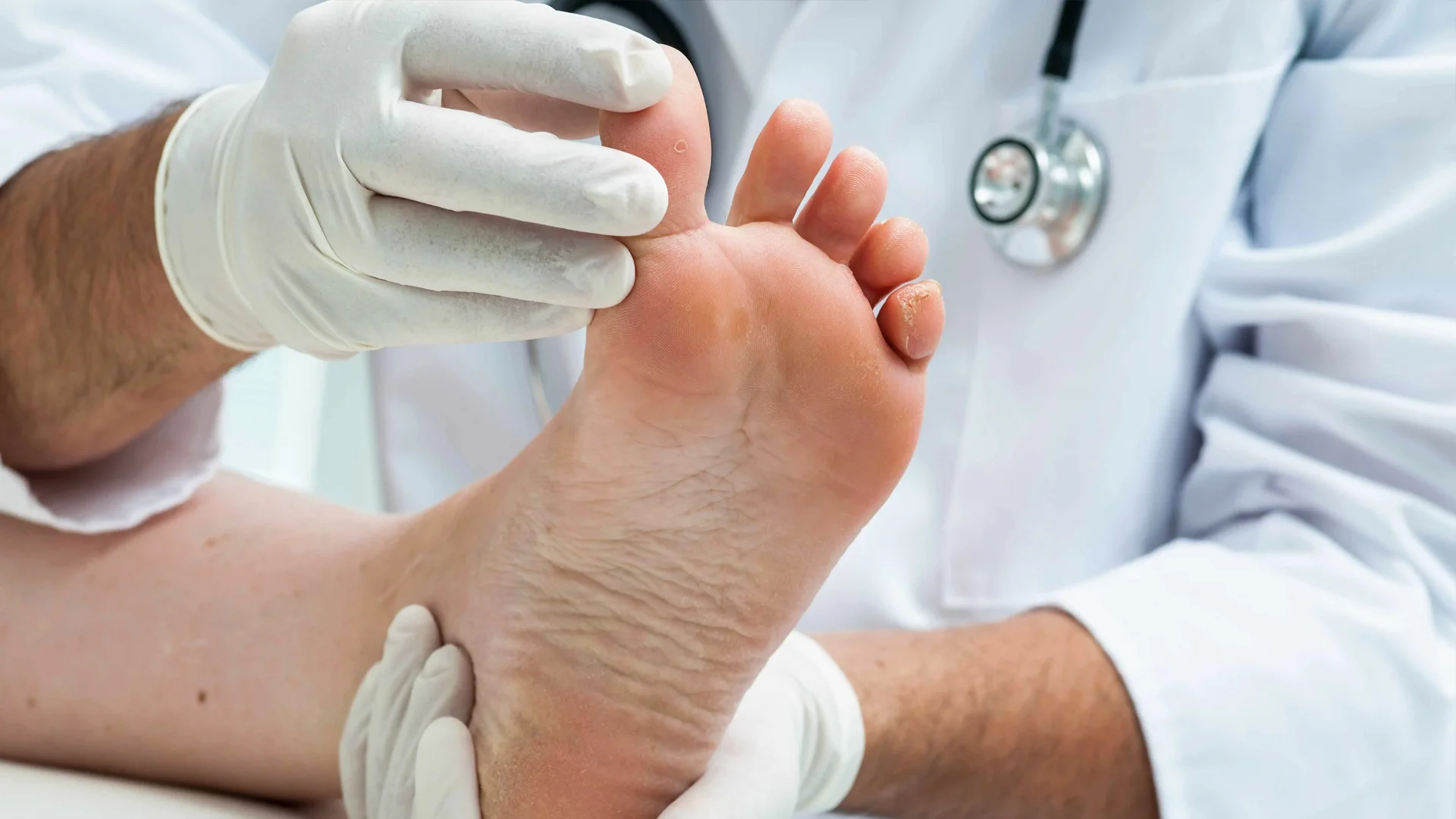 Traitement des Infections Fongiques