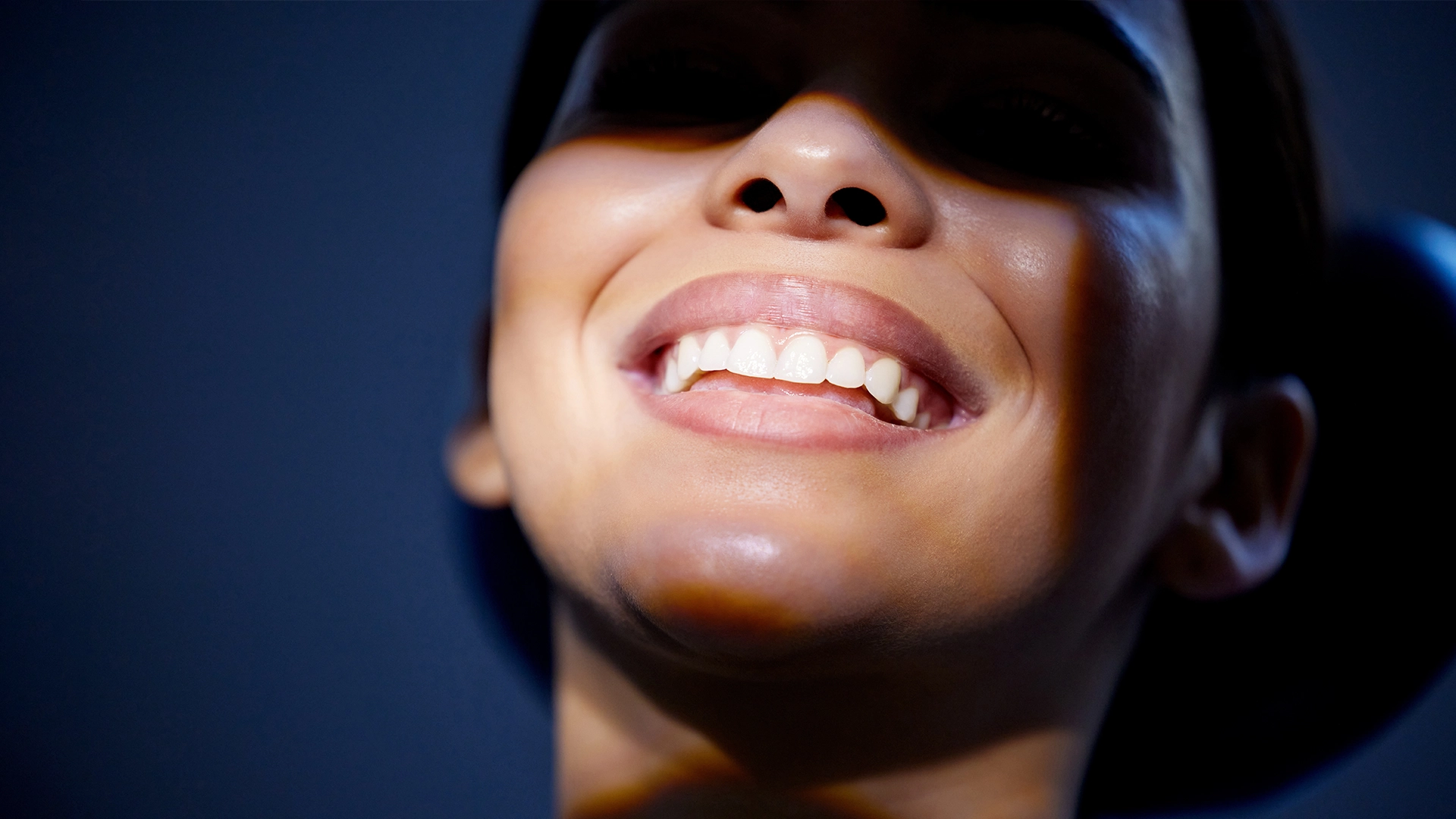 hollywood smile