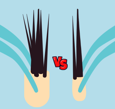 Hair Toupee vs. Hair Transplant: Which One Will Make Your Life Easier?
