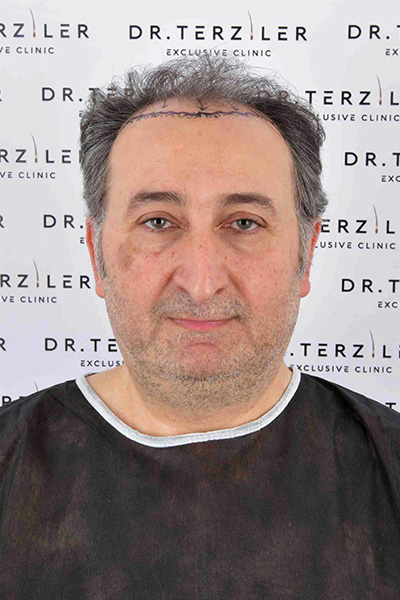 Öncesi
