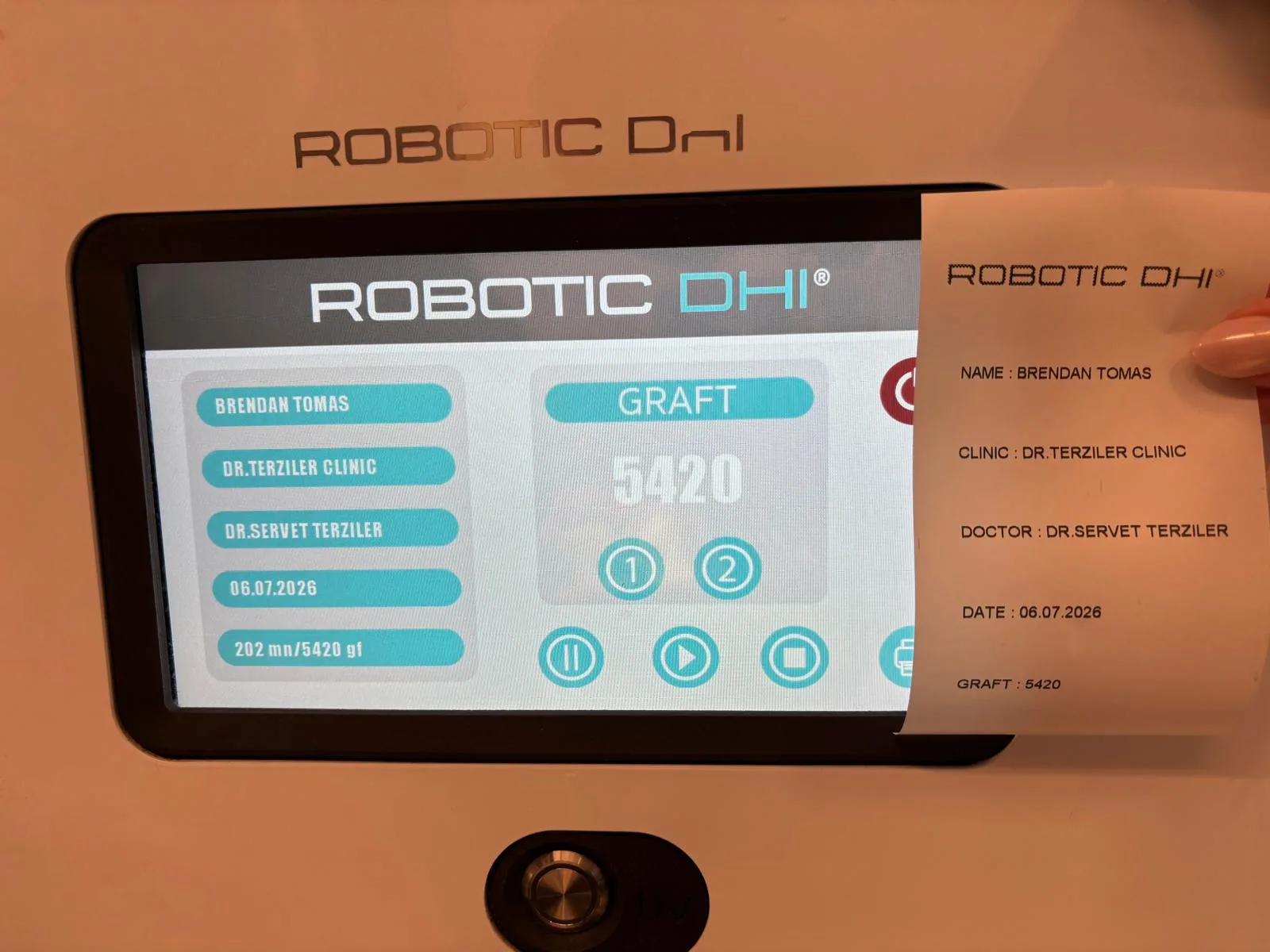 Dr. Terziler Robotik DHI cihazında ger&ccedil;ek zamanlı greft sayacı ve operasyon sonunda verilen greft kayıt belgesi