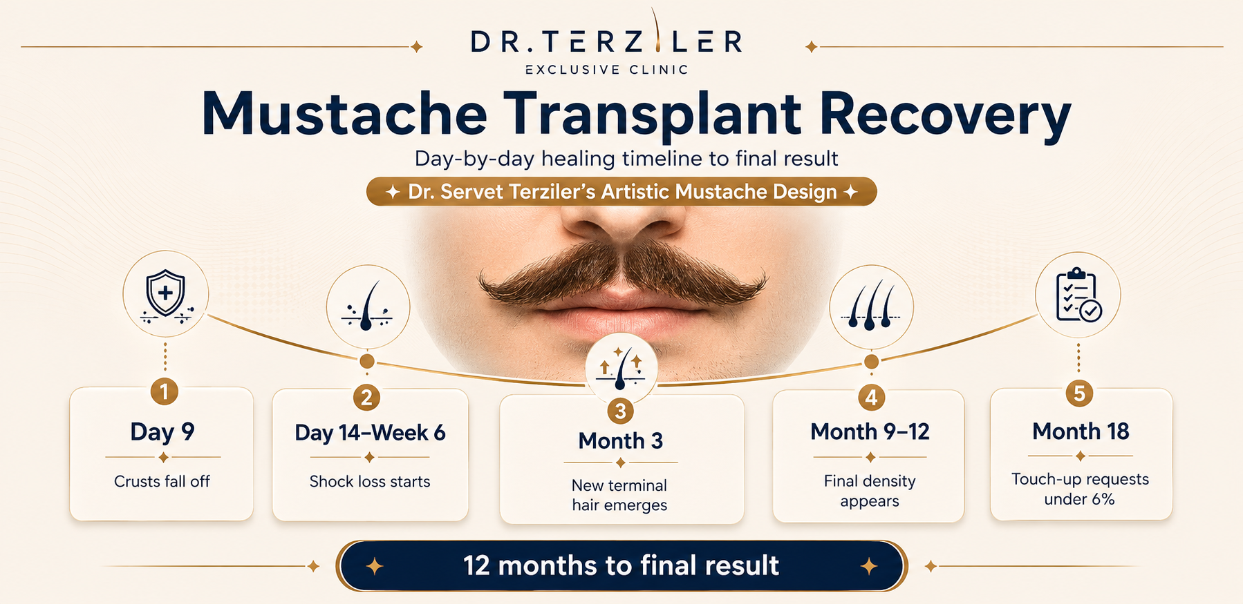 Moustache transplant recovery timeline Turkey, day by day healing from first wash to month 12 growth at Dr. Terziler Exclusive Clinic