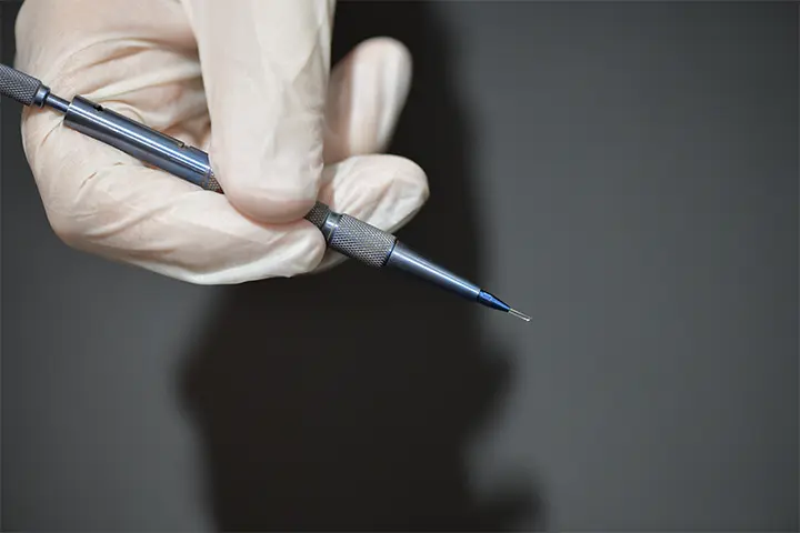 Choi implanter pen used for beard transplant in Turkey Robotic DHI facial hair restoration at Dr. Terziler Exclusive Clinic