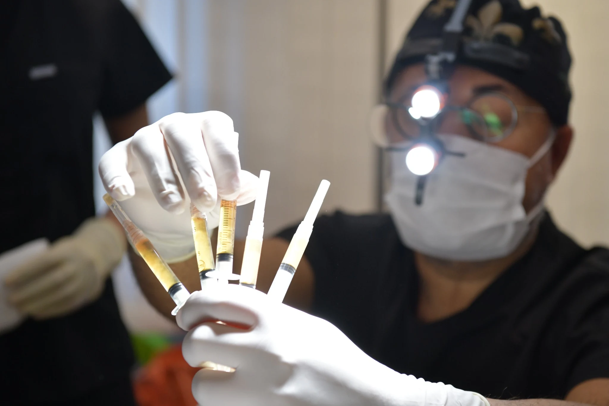 Dr. Servet Terziler wearing surgical loupes and gloves holds syringes prepared for ACell and PRP hair restoration treatment at Dr. Terziler Exclusive Clinic.