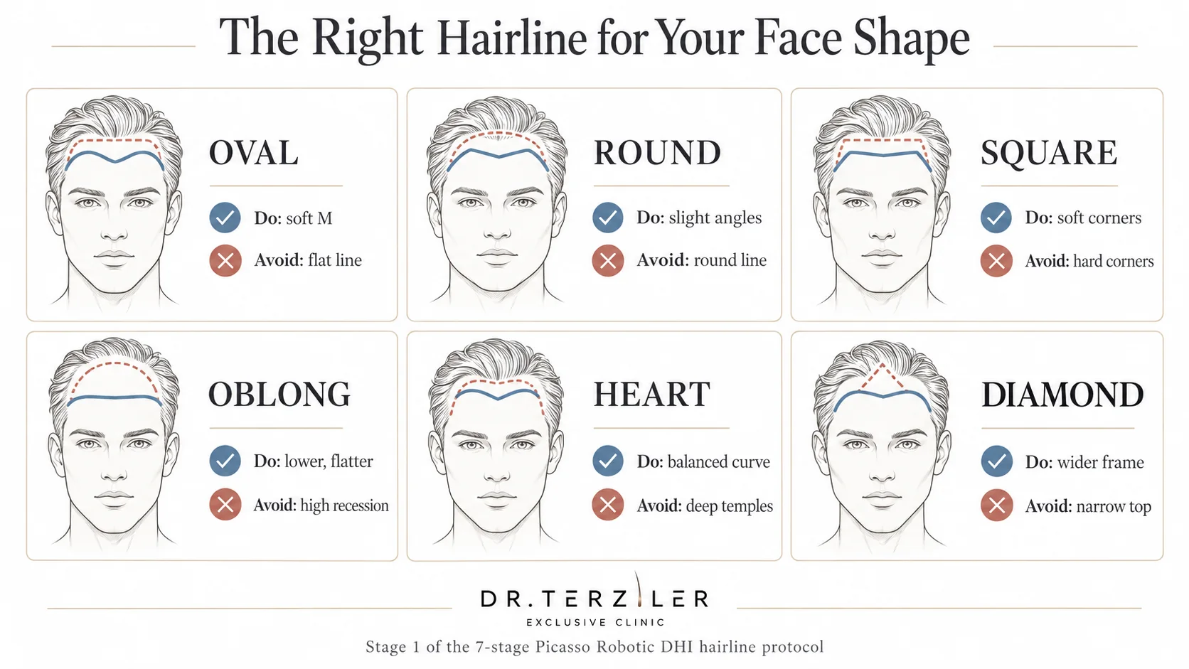 Hairline design by face shape: oval, round, square, oblong, heart and diamond