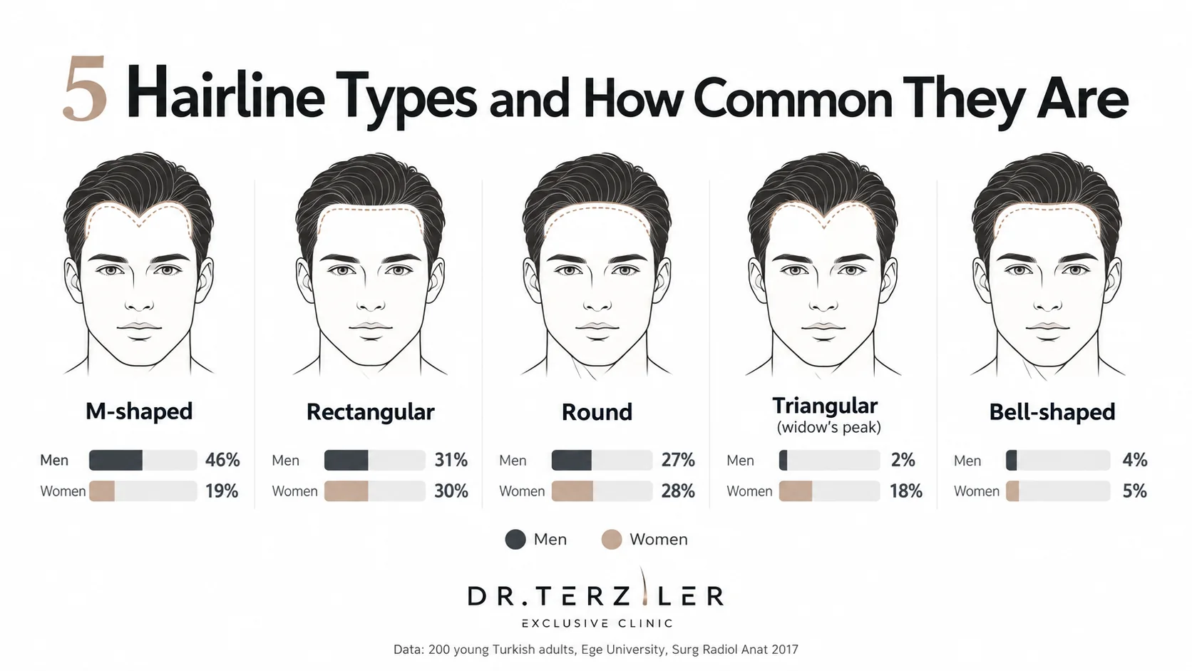 Five hairline types chart: M-shaped, rectangular, round, triangular widow's peak and bell-shaped with prevalence in men and women
